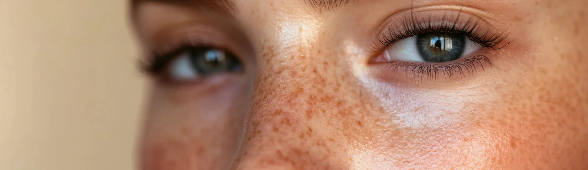 Момиче с лунички