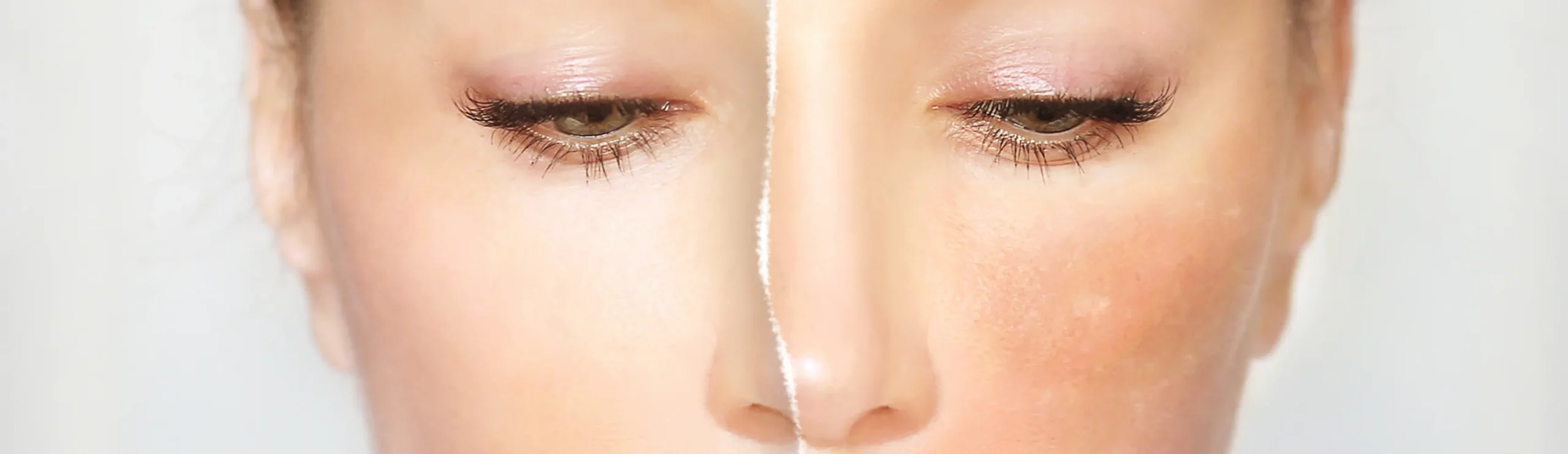 С понижаването на температурите и влажността кожната бариера става още по-уязвима – губи вода по-бързо, повишава се pH-то, а кожата става по-чувствителна и податлива на възпаления